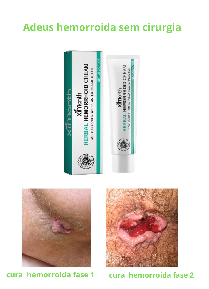 Creme para hemorroida-Himorth herbal