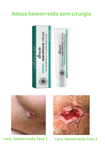 Creme para hemorroida-Himorth herbal